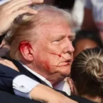 Trump's Ear Wound