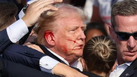 Trump's Ear Wound